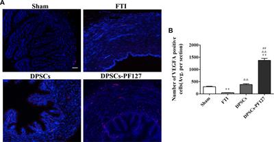 Application of thermosensitive-hydrogel combined with dental pulp stem cells on the injured fallopian tube mucosa in an animal model